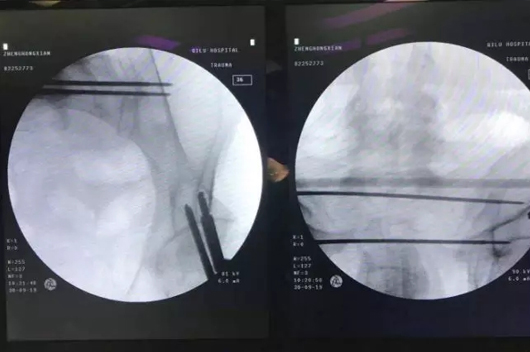 1589427177763257.jpg 5.jpg