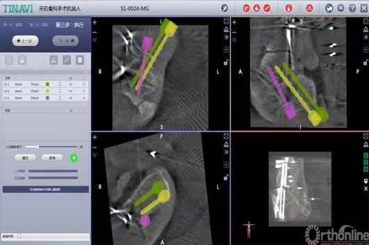 1589437064273502.jpg 2.jpg