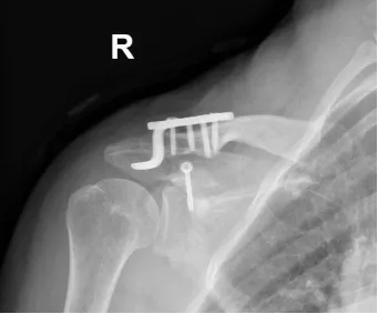 1594107233610972.jpg 640.webp (2).jpg